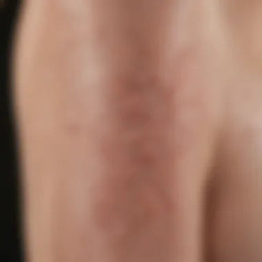 Close-up of keratosis pilaris on skin